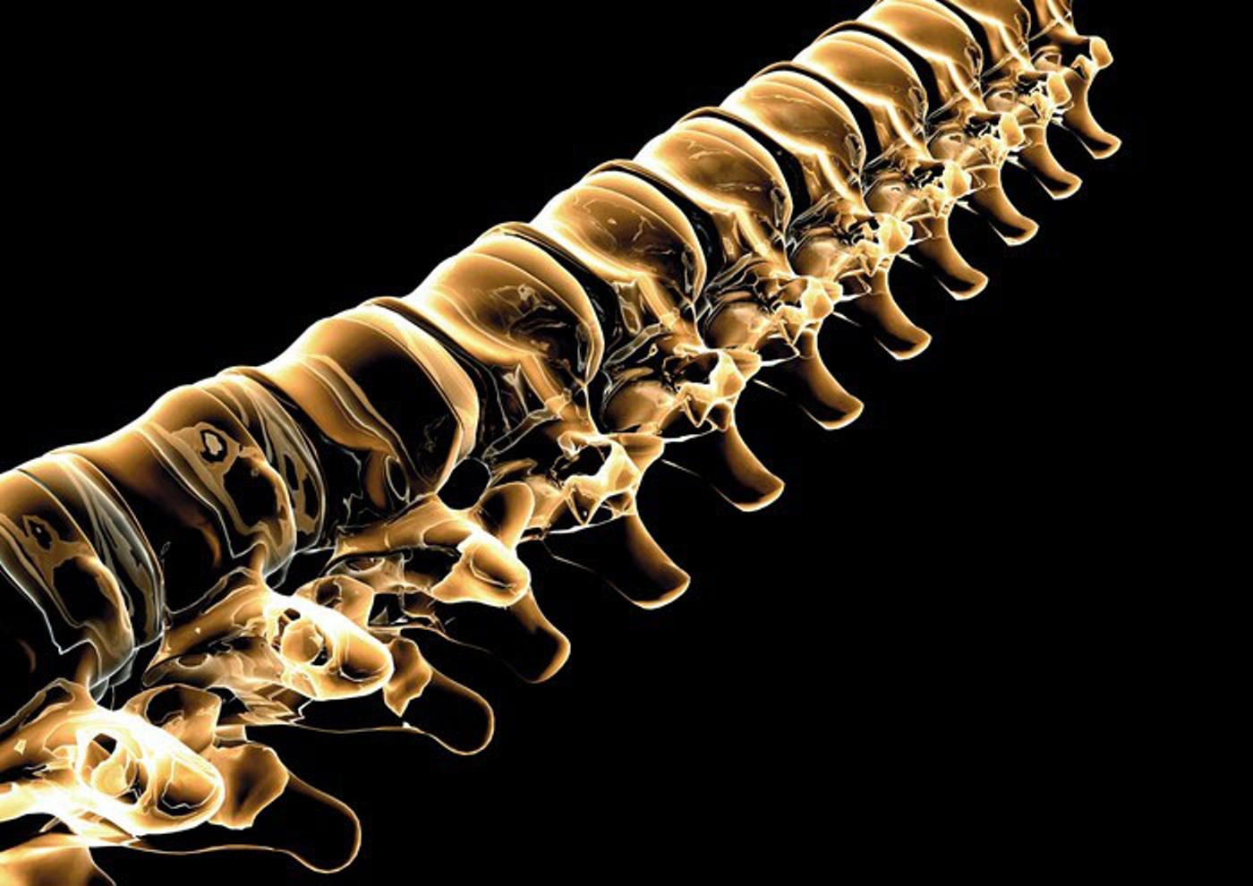 of X ray human bones spine free desktop background   free wallpaper