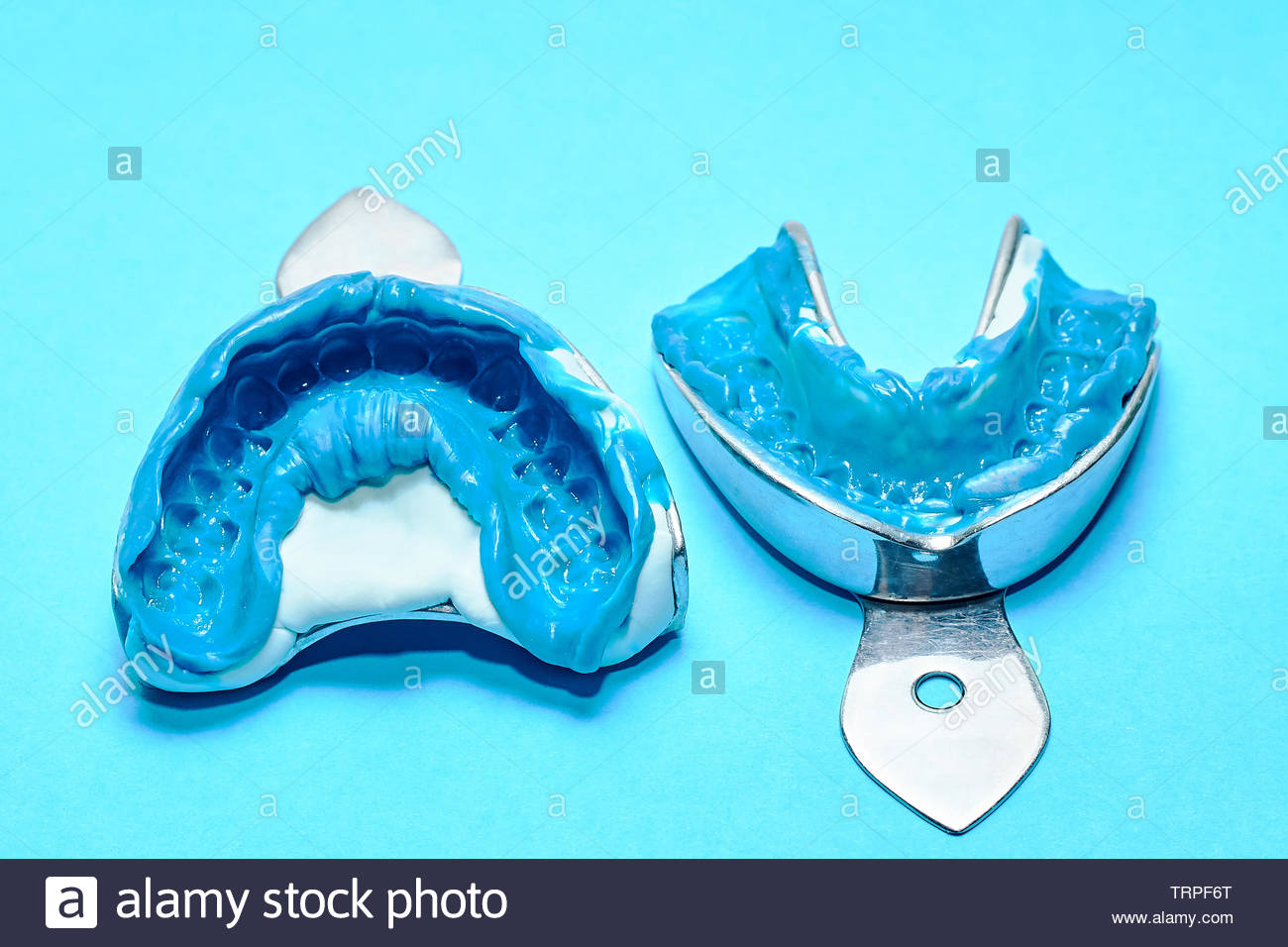 Two Dental Impressions On A Blue Background Molds From The