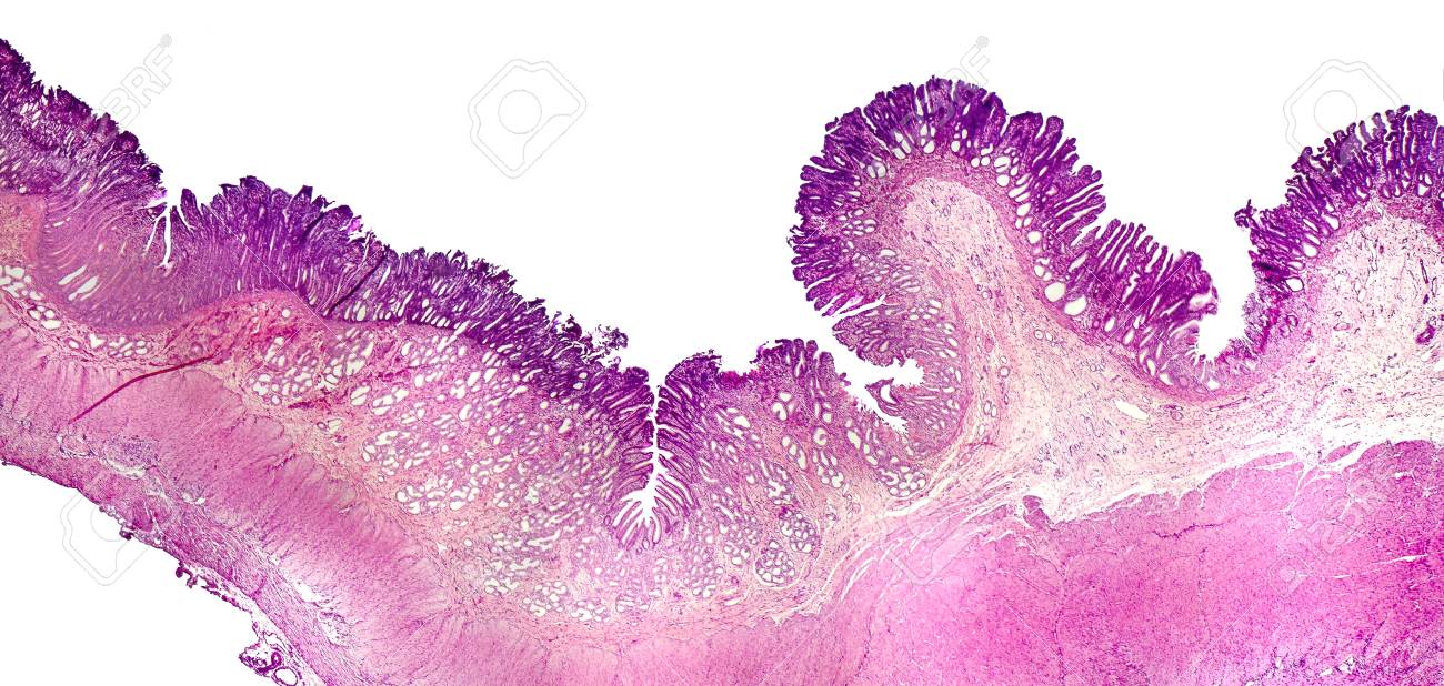 Histology Of Human Stomach Pylorus Part Light Micrograph