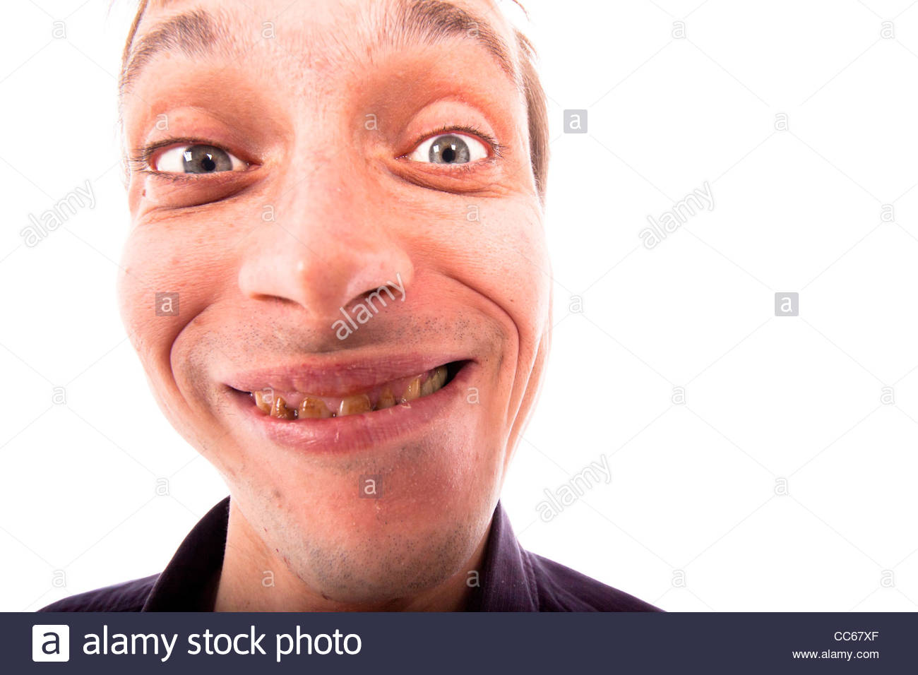 Detail Of Ugly Man Face Isolated On White Background Stock Photo