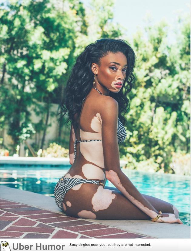 Winnie Harlow Funny Pictures Quotes Pics Photos Image