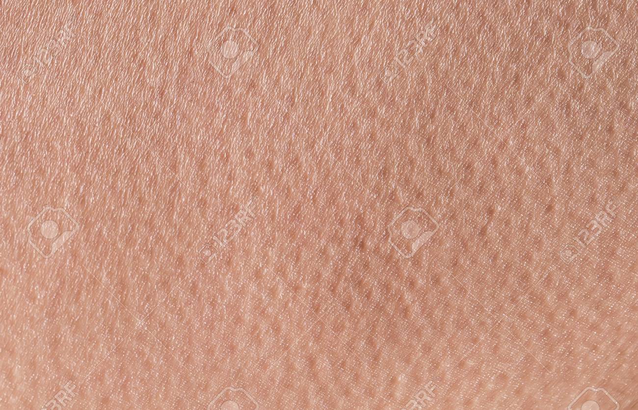 Background Of A Pink Skin Texture Man Covered With Pores