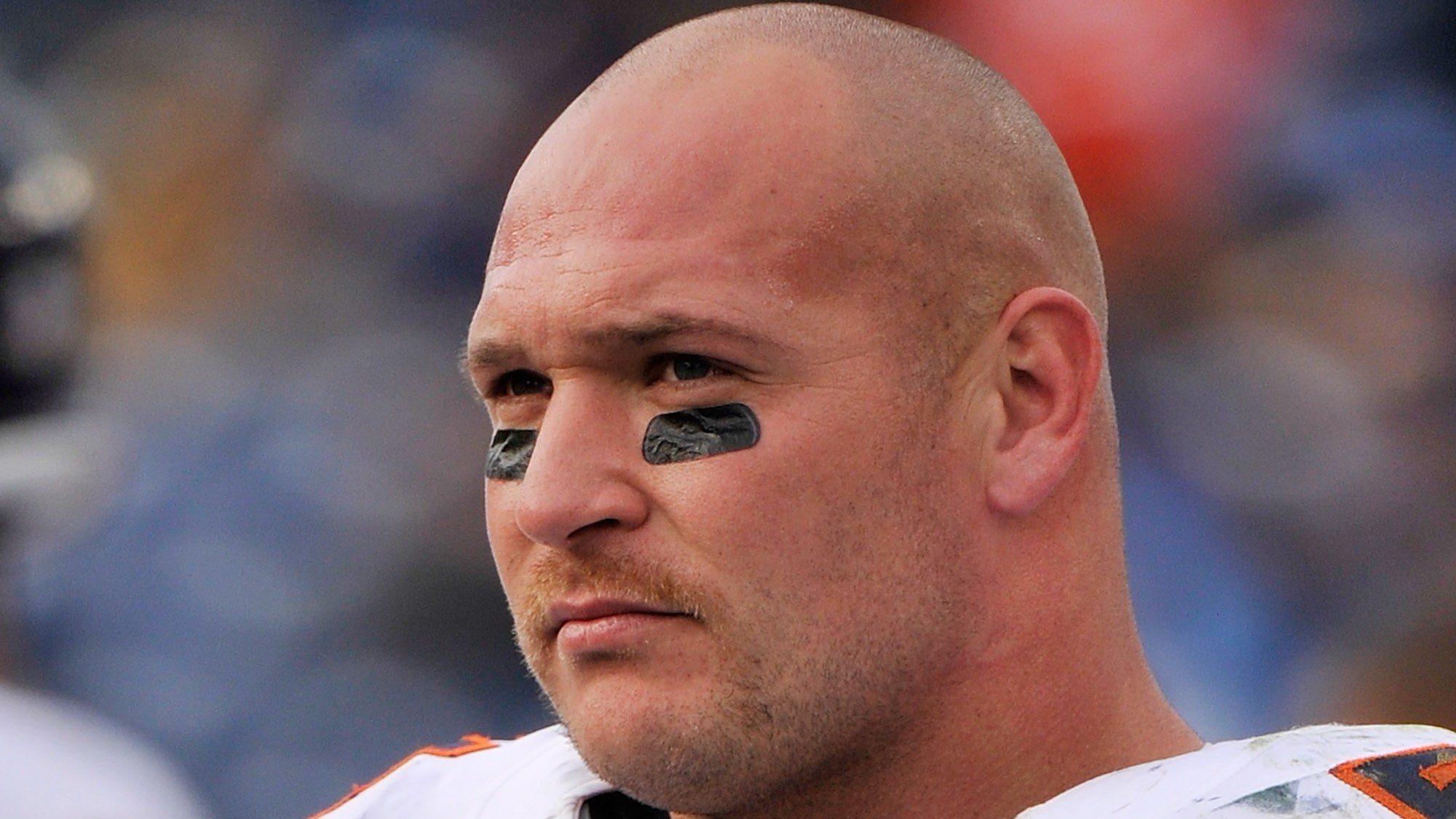 Brian Urlacher Had Surgery For Hours To Get His Hair Back Gq