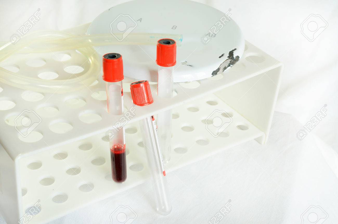 Free download Blood Sampling And Analysis In A Biochemical Laboratory On A [1300x860] for your