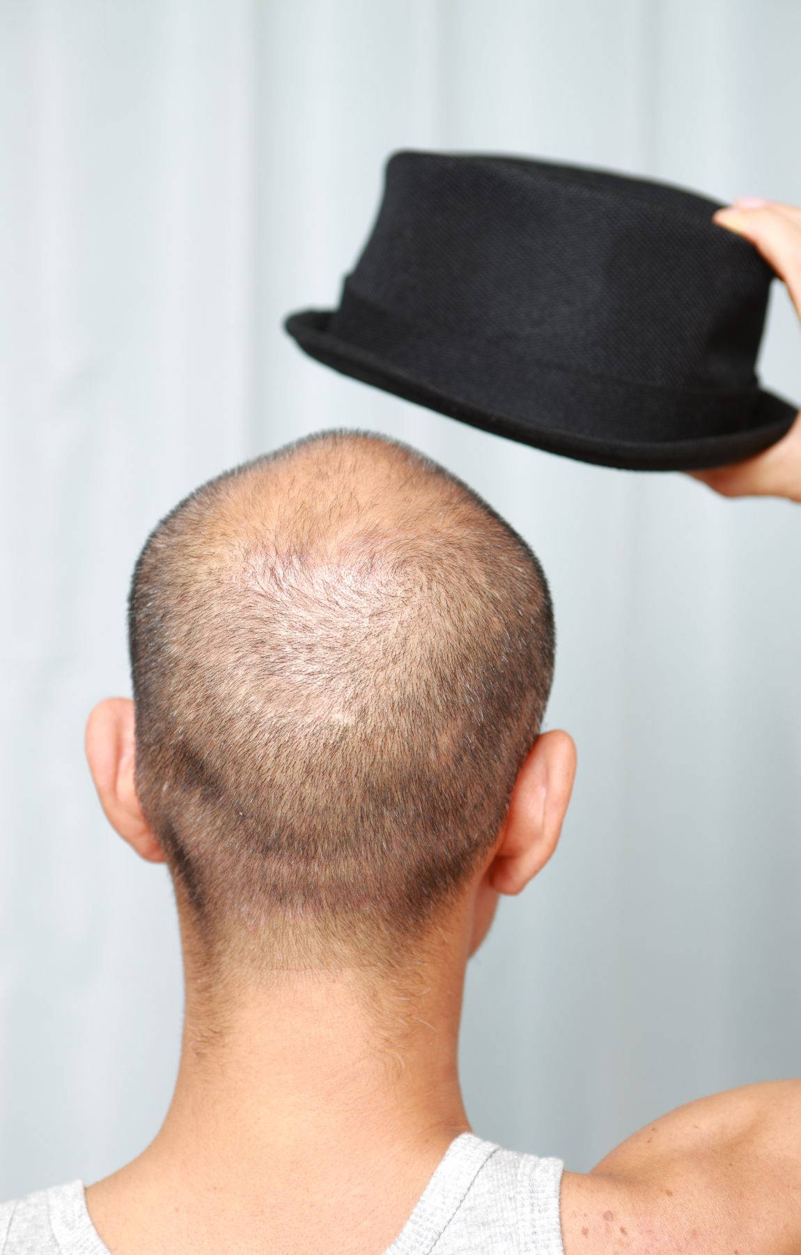 Bald Man Holding Black Hat Wallpaper