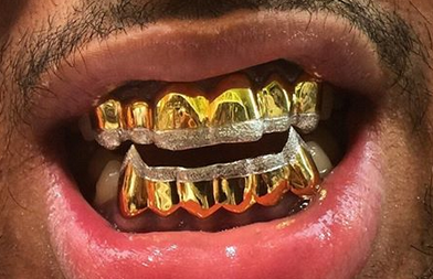 Top Gold Teeth Wallpaper