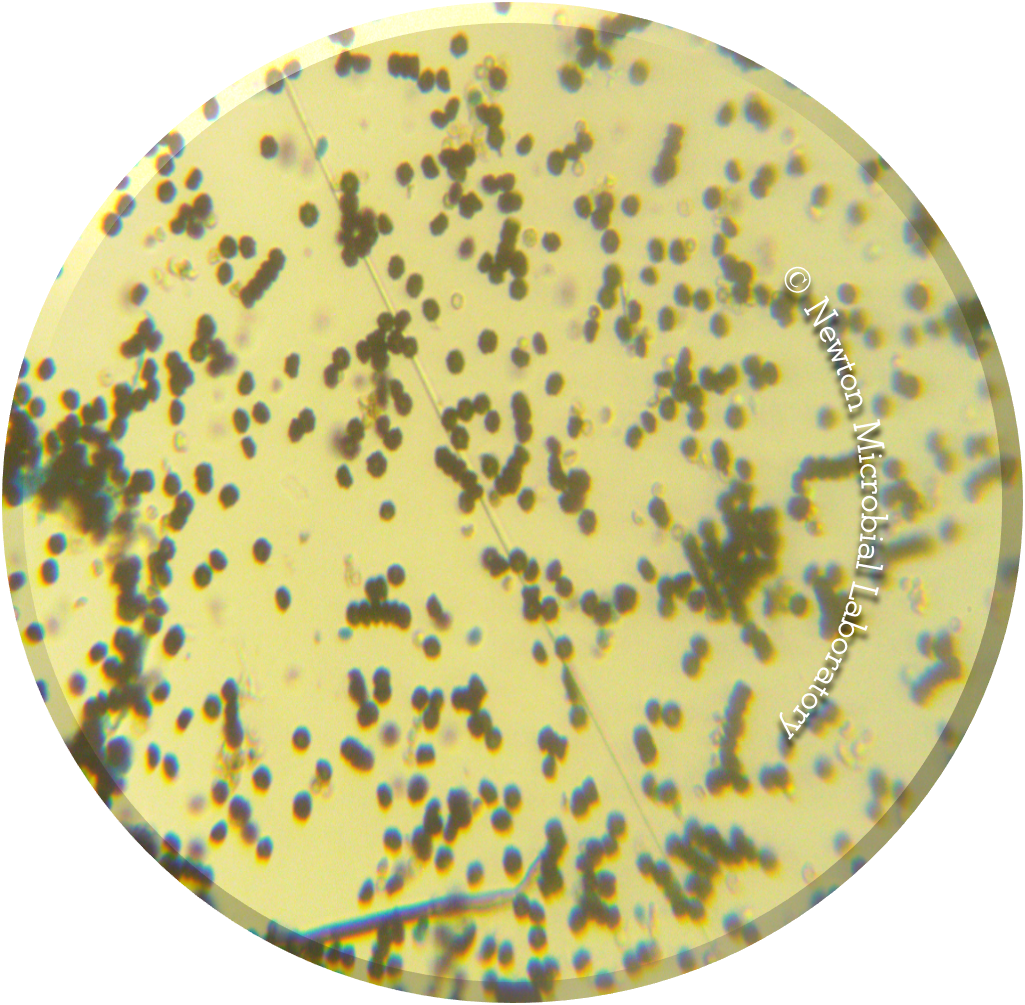 Black Mold Pictures Under The Microscopes Awareness