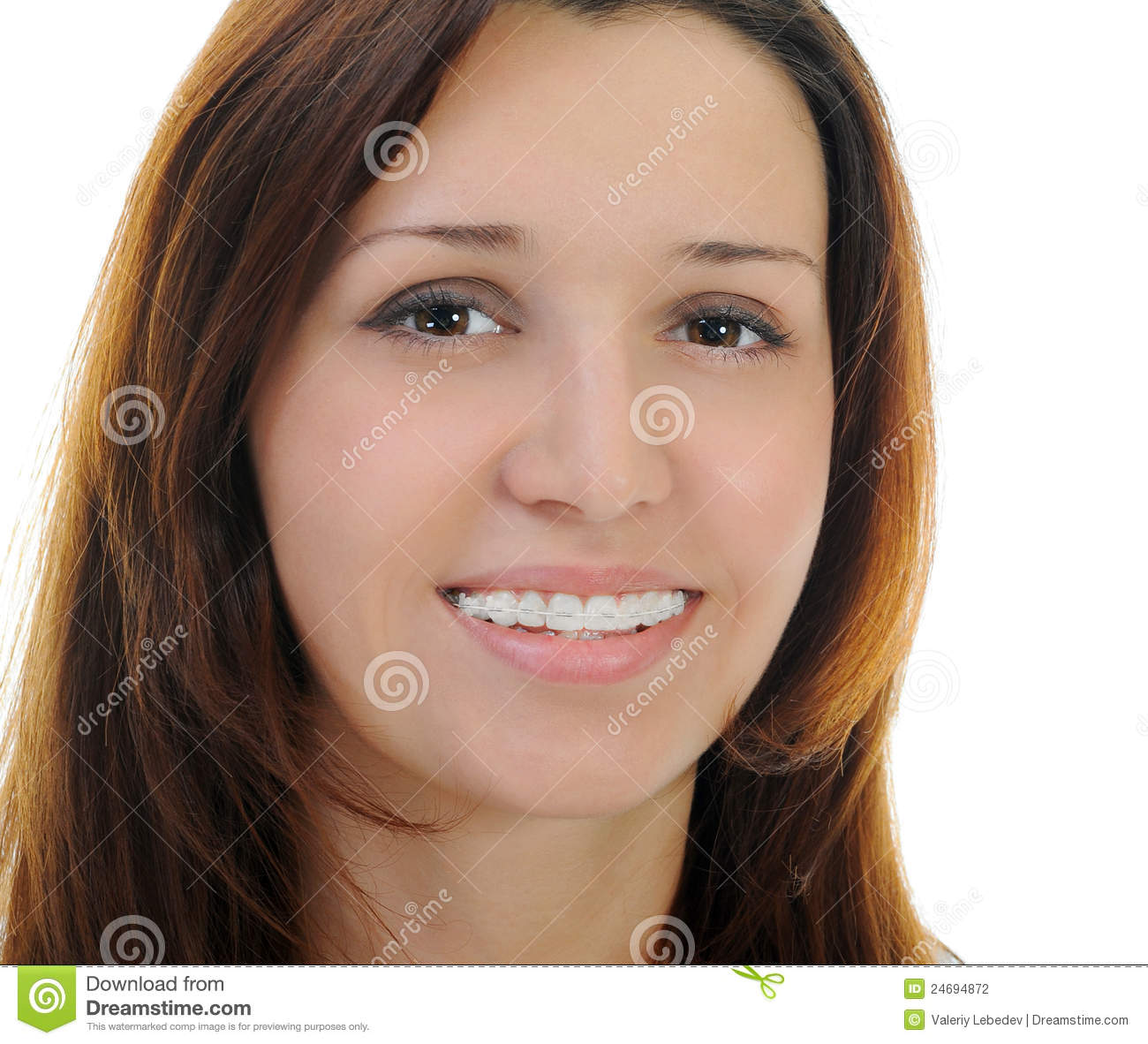Portrait Of Beautiful Teen Girl In Braces Isolated On A White