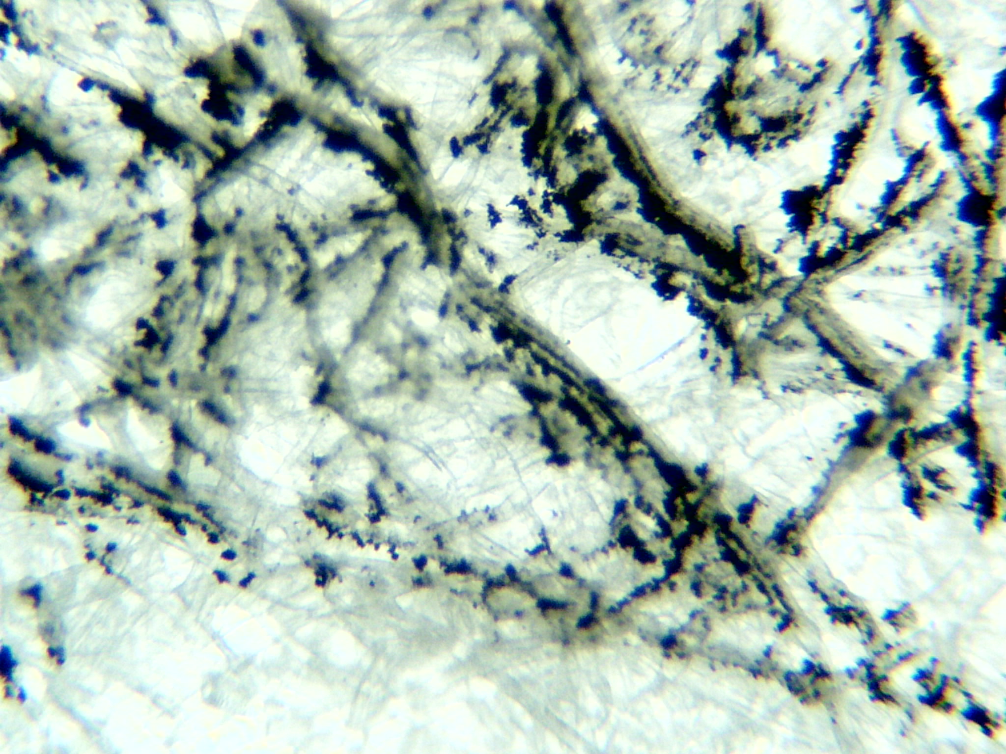 Displaying Image For Mold Under A Microscope HD Wallpaper
