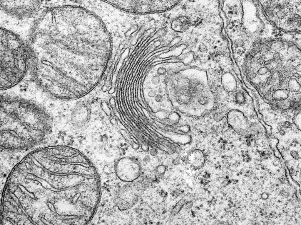 Electron Microscopy Golgi Apparatus Mitochondria