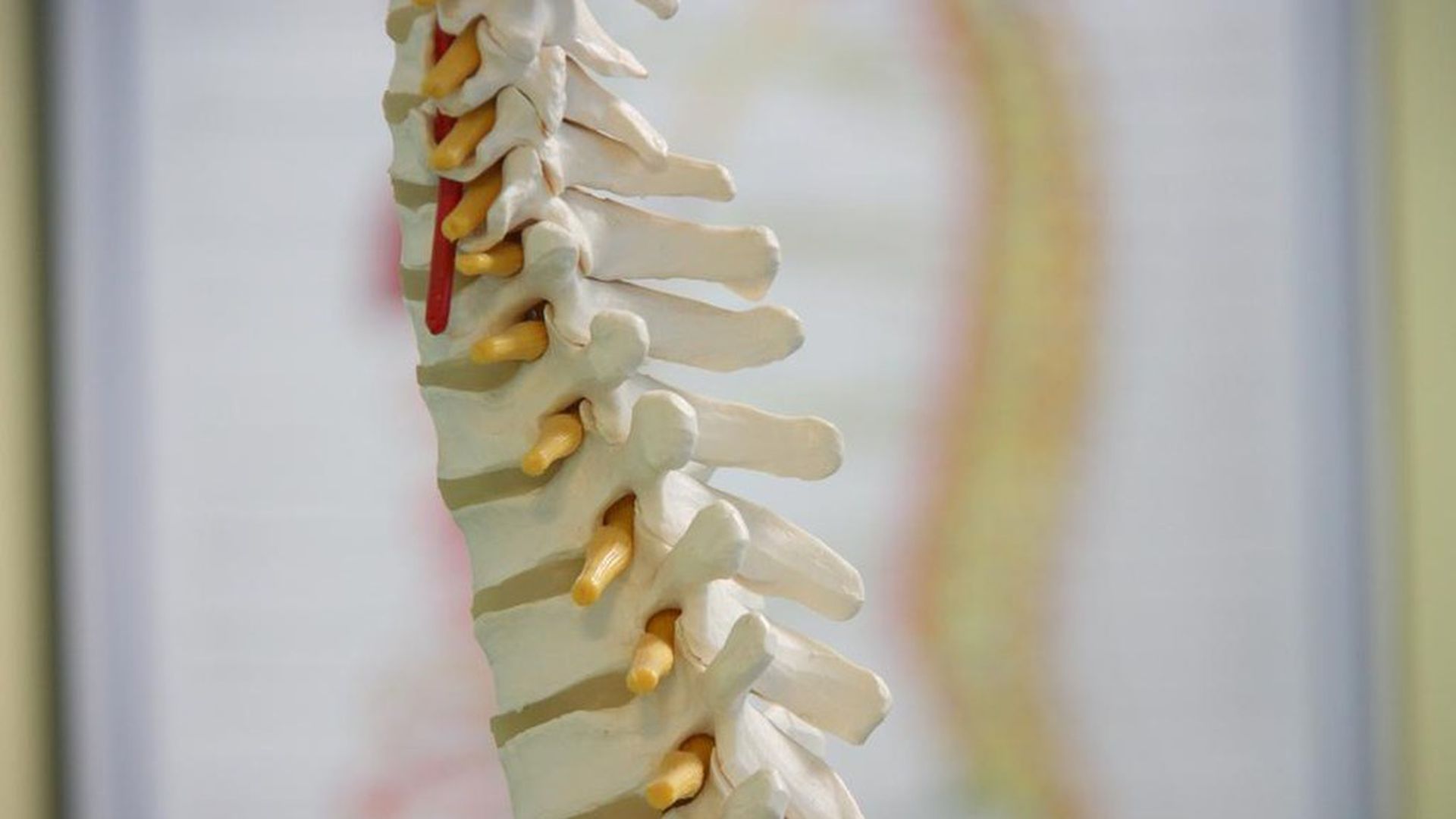 Zimmer Biomet Recalls Spine Devices Axios