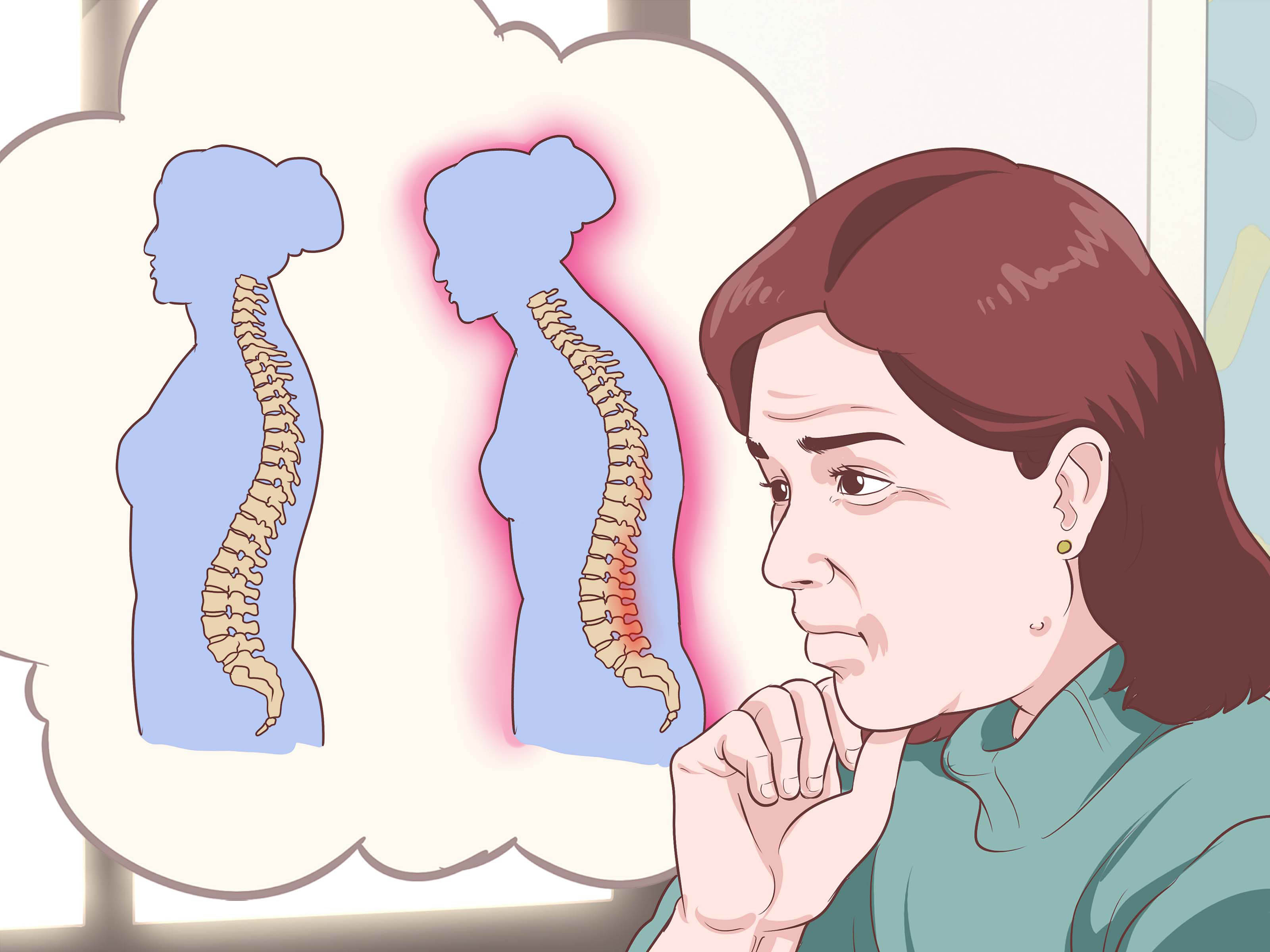 How To Diagnose Adult Scoliosis Steps With Pictures